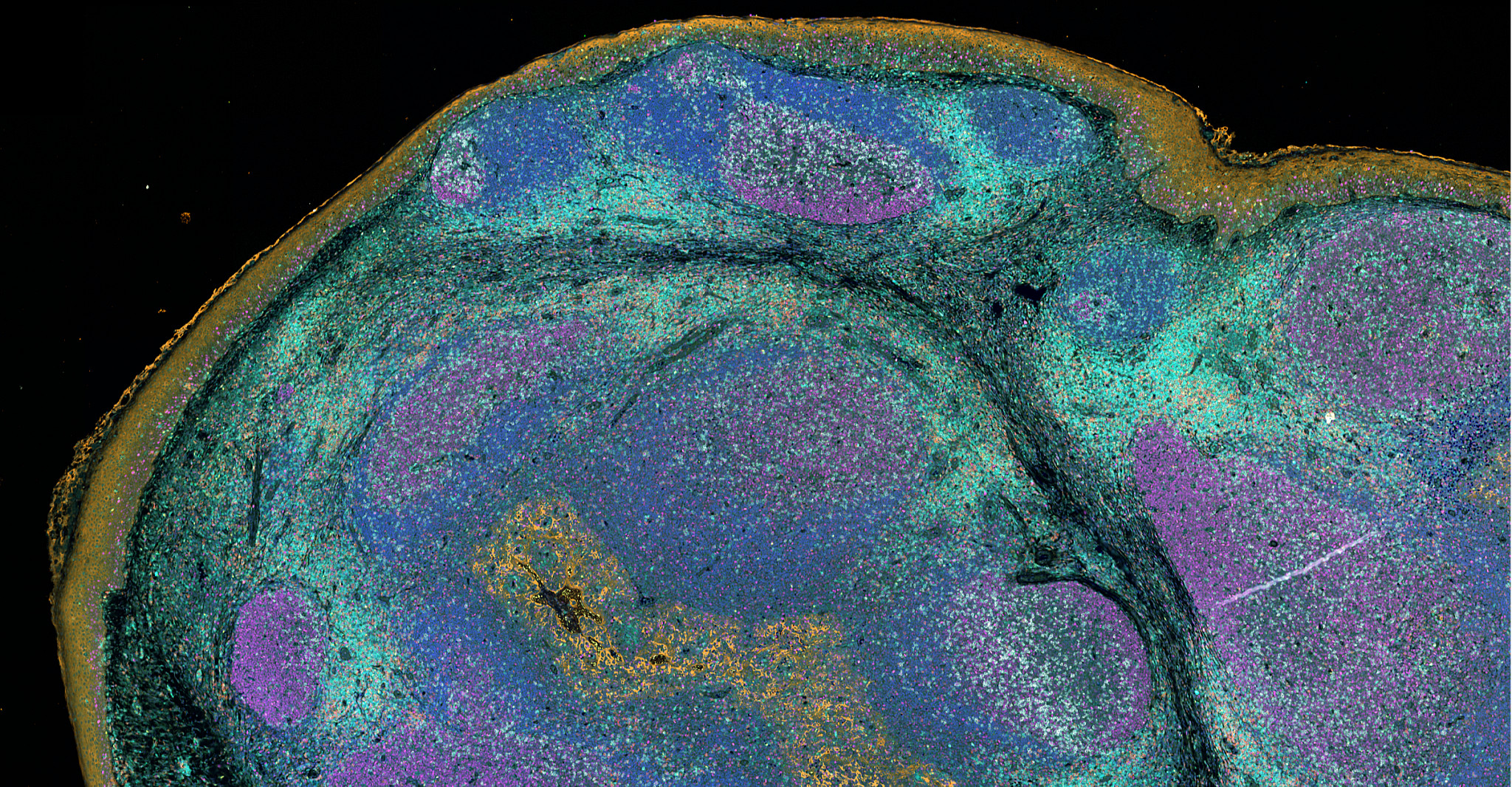 Tonsil section illustrating high‑plex spatial pathology and proteomic biomarker mapping.