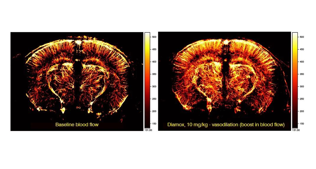 Functional ultrasound in 5xFAD mouse model