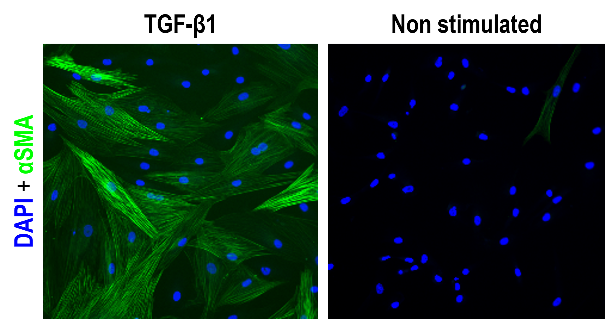 high content-based assay designed to measure TGF-β1-induced SMT IMAGE
