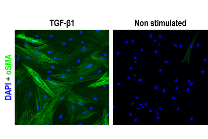 high content-based assay designed to measure TGF-β1-induced SMT IMAGE