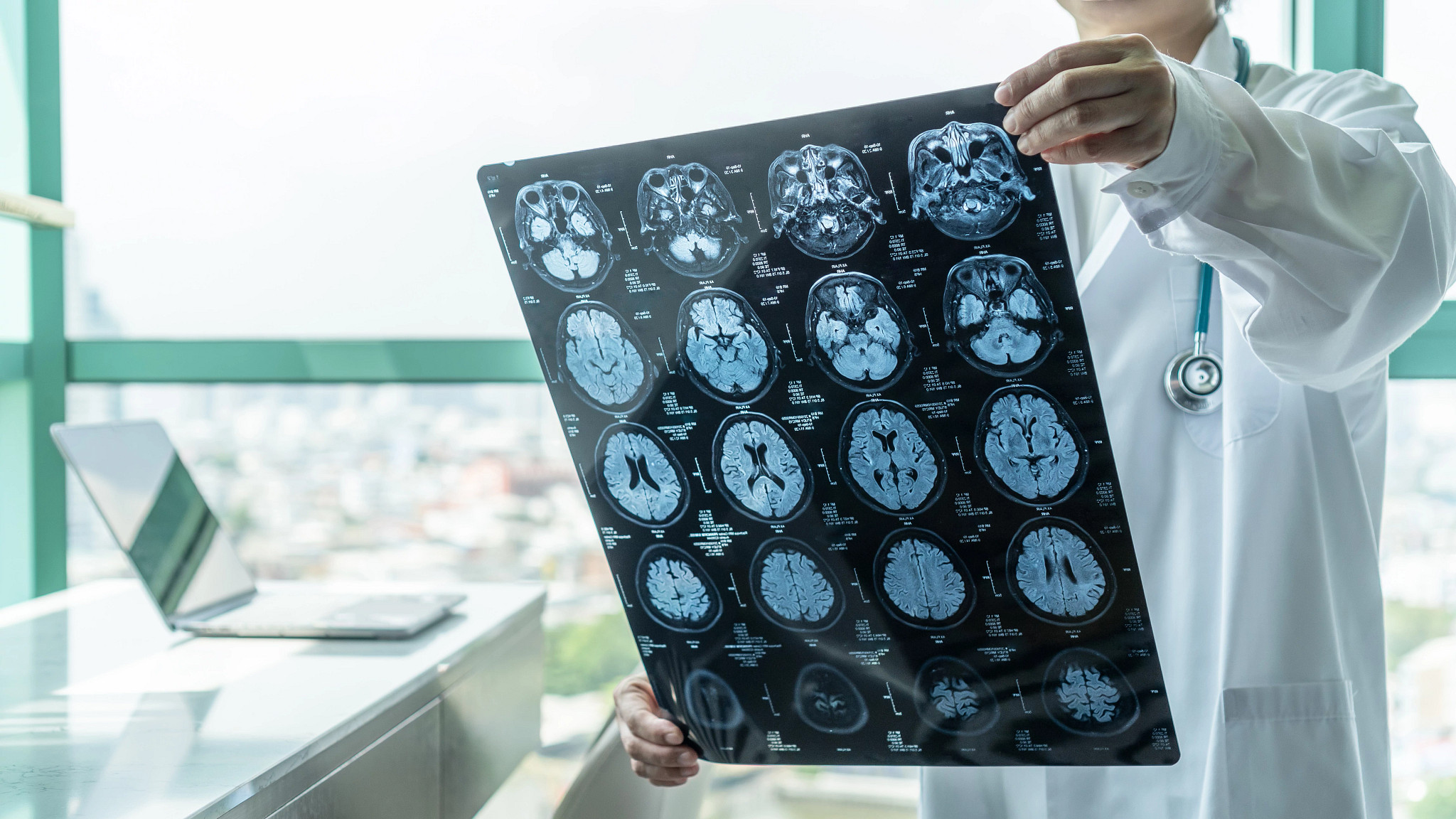 medical doctor holding up Magnetic Resonance Imaging (MRI) film diagnosing neurodegenerative
