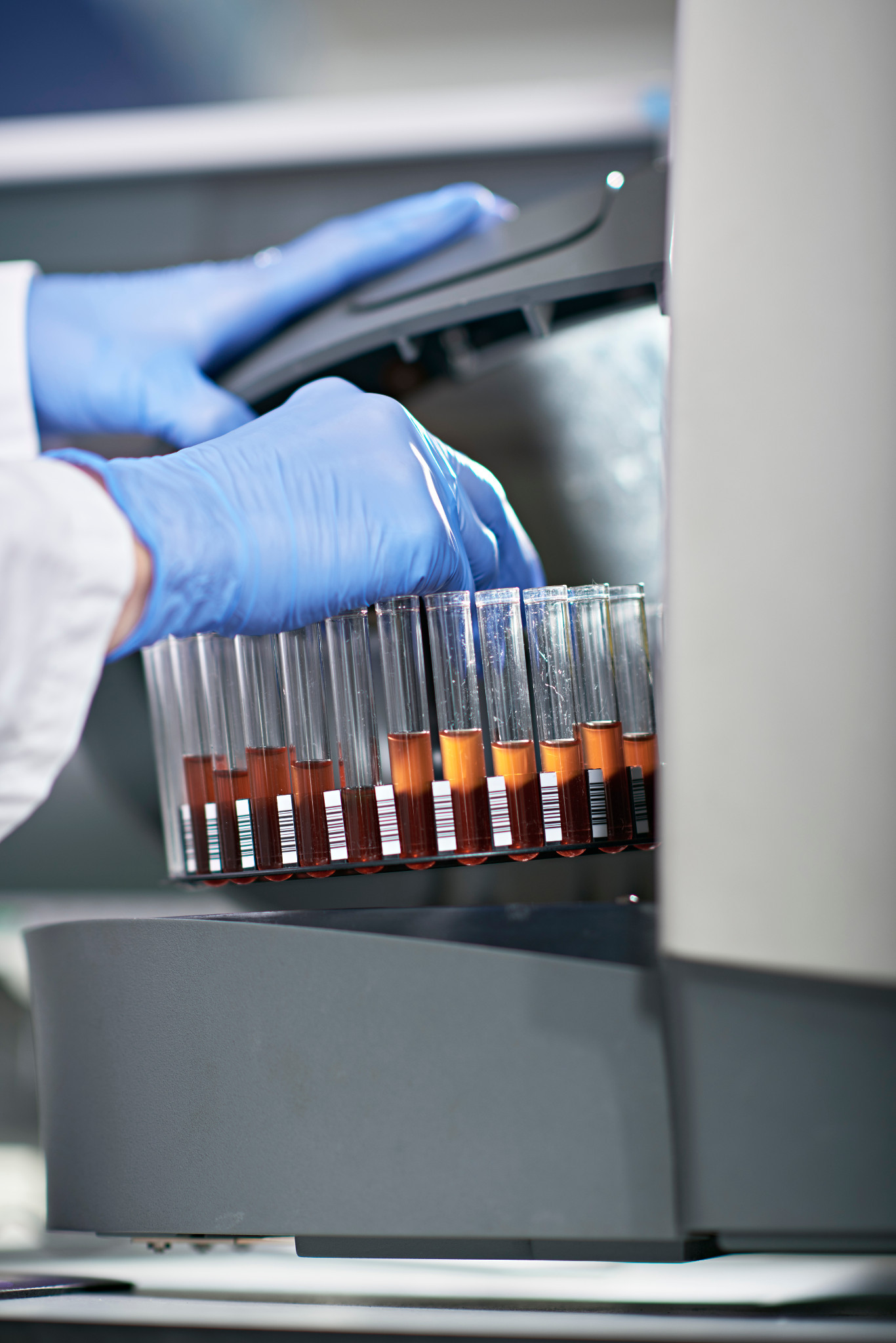 Flow cytometry used for immunophenotyping
