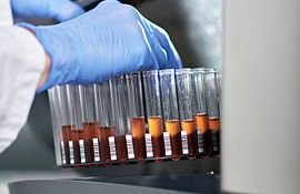 Flow cytometry used for immunophenotyping