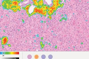 Digital pathology slide