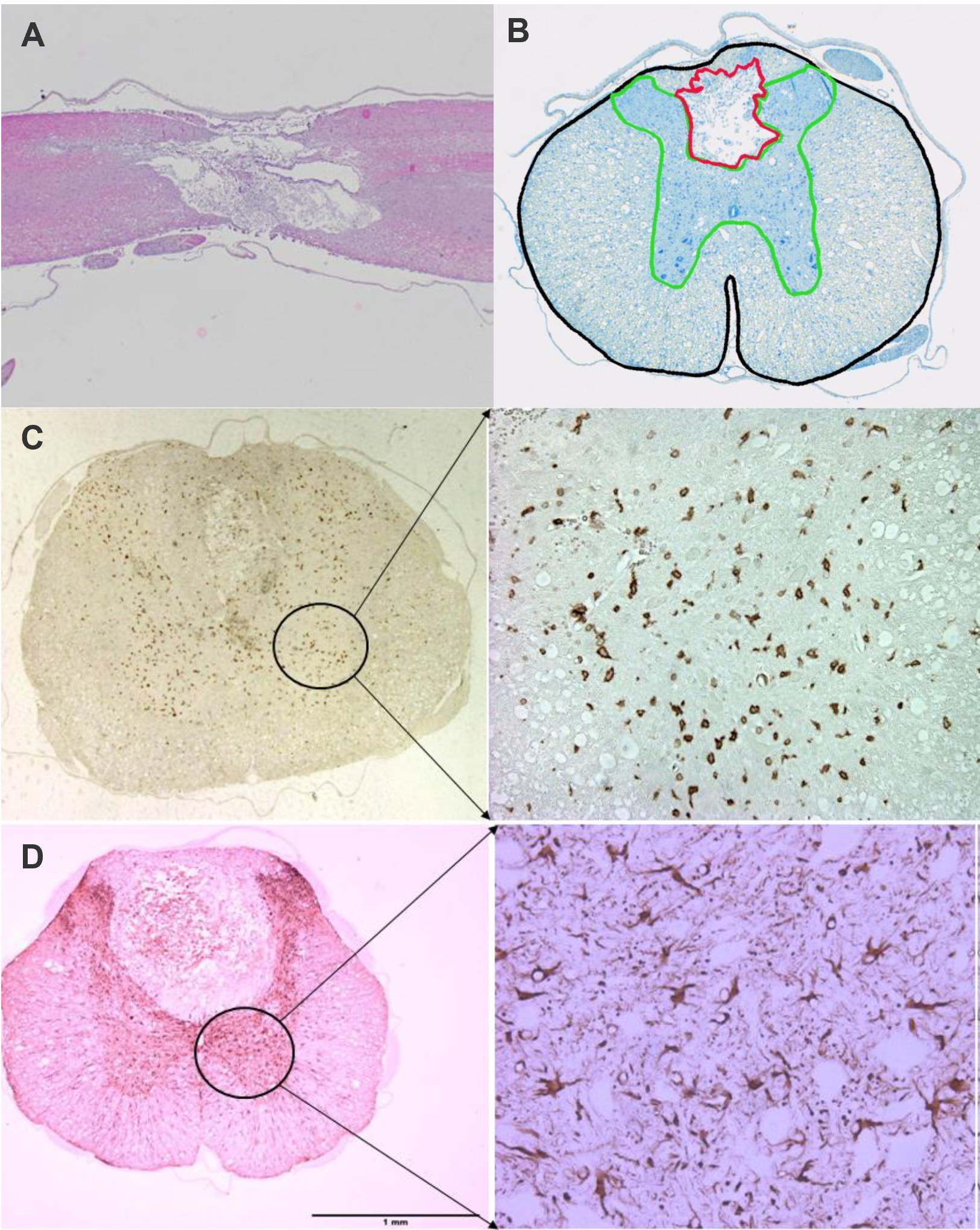 Spinal cord injury histology data