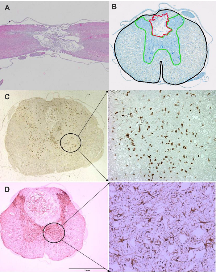 Spinal cord injury histology data