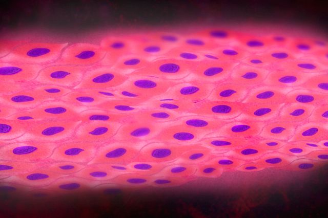 Cancer Cachexia Model | Charles River