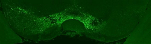 Green graph showing TH-positive cells for Alpha-synuclein Immunoreactivity in the AAV-A53T Alpha-synuclein Model.