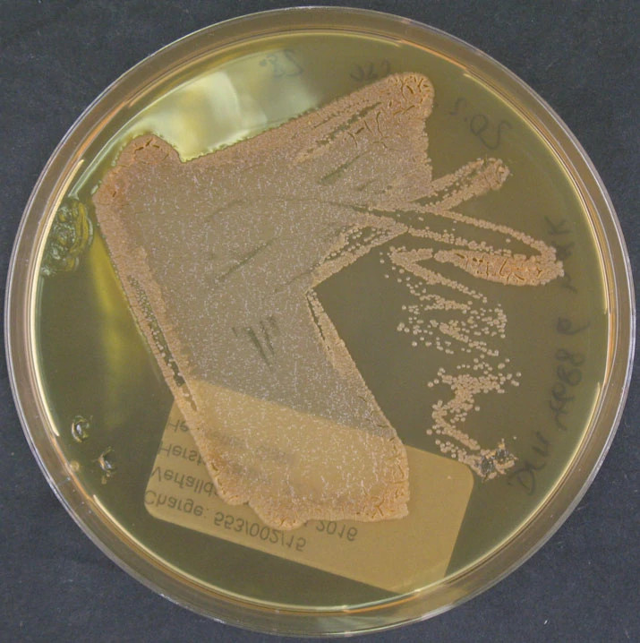 Saccharothrix ghardaiensis.jpg