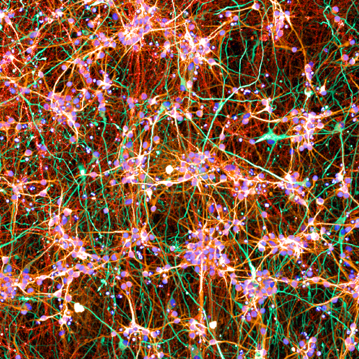 neurons (red, MAP2) and astrocytes (green, GFAP)