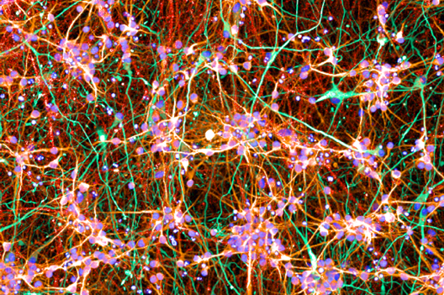 Immunofluorescence image showing human iPSC-derived neurons and astrocytes in co-culture
