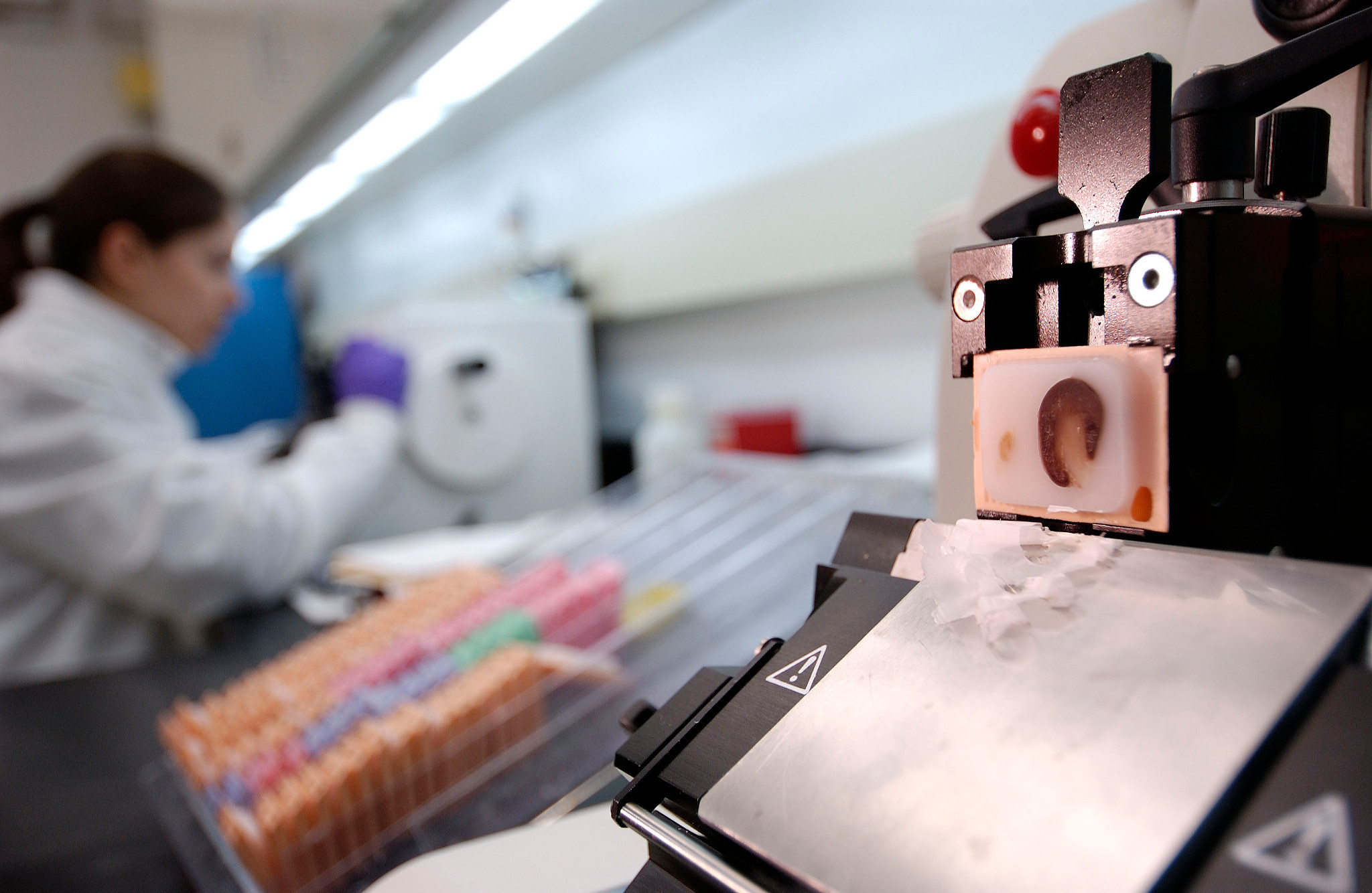 Microtome cutting sections from an FFPE tissue block in a histology lab.