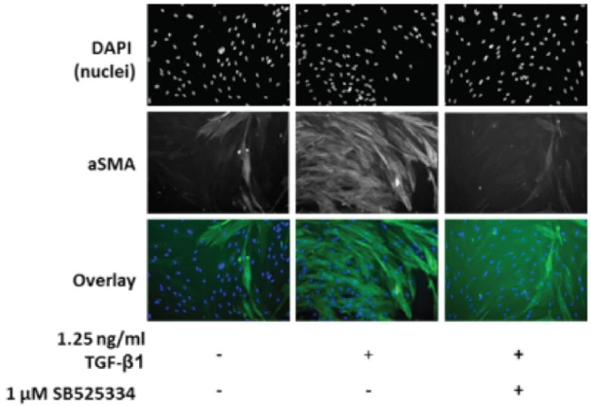 Image is from the Fibroblast-to-Myofibroblast Transition (FMT) Assay. It displays the levels of lung-derived fibroblasts from the TGF-β1 trigger via high content imaging.