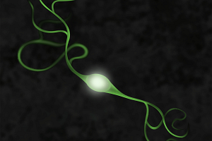 1-a9-dopamine-neuron-2-green.png