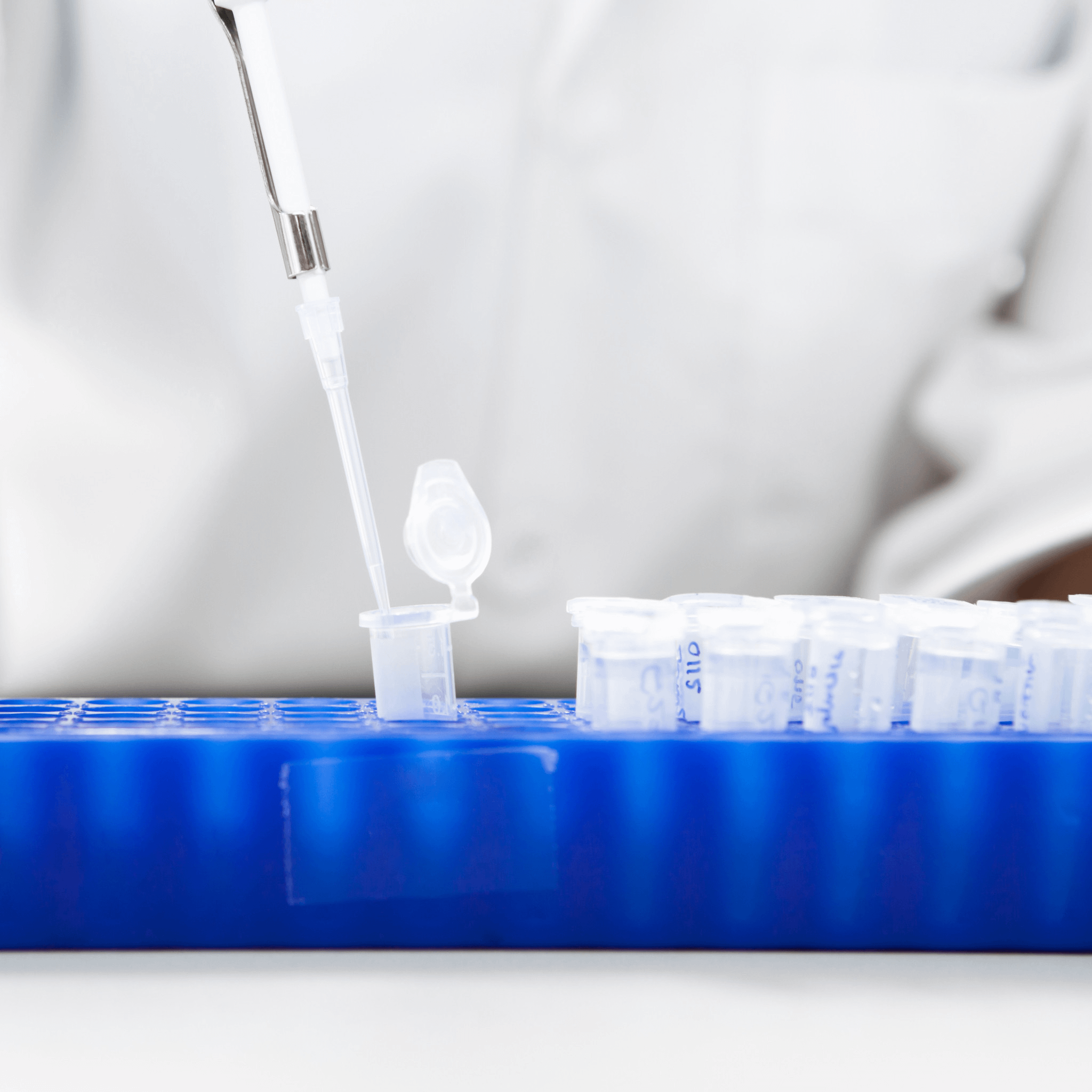 Laboratory micro pipette drops the biological solution in eppendorf