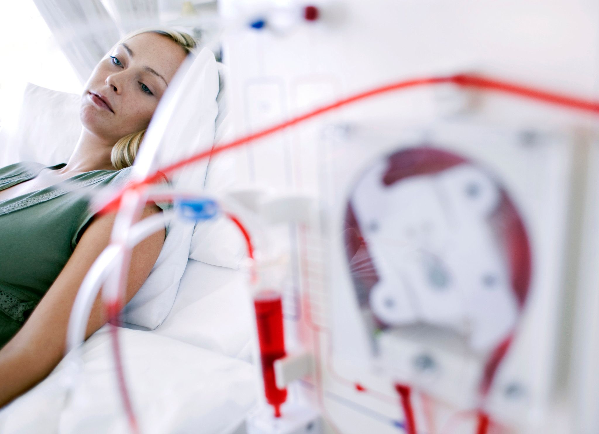 Woman receiving dialysis after dialysis water was tested for endotoxins with Charles River Endosafe nexgen-PTS