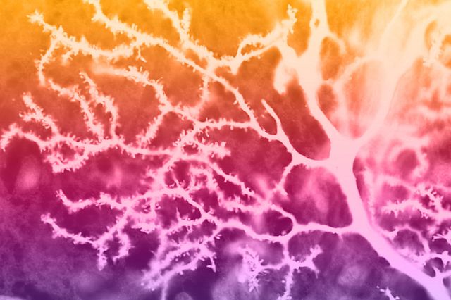 Pyramidal neurons are found in certain areas of the brain including the cerebral cortex, the hippocampus, and the amygdala.