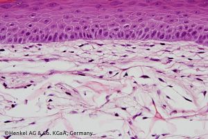 Phenion FT skin model histology