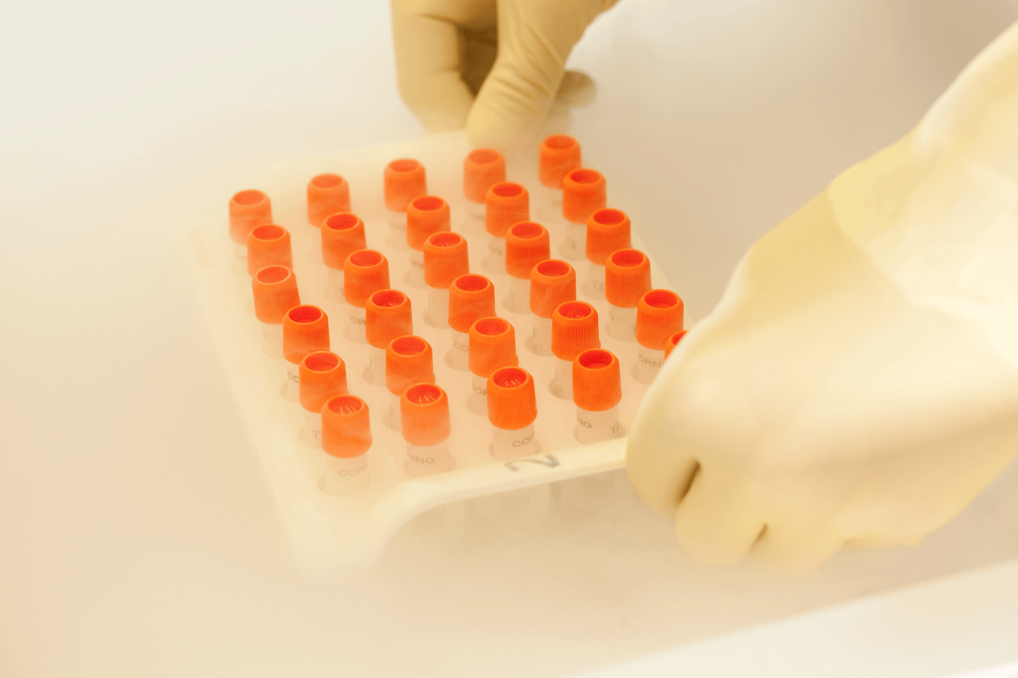 Lab technician handling tray of tubes of NK Cells or Cytotoxic T Cells