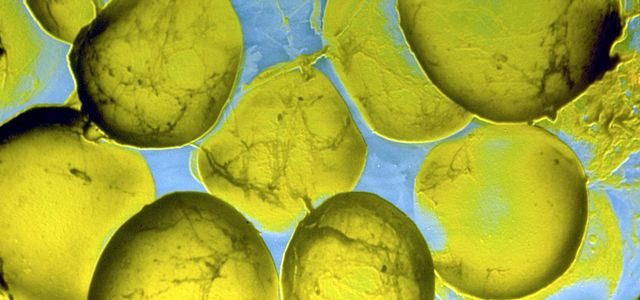 micro_electron_ fatcells_0001.jpg