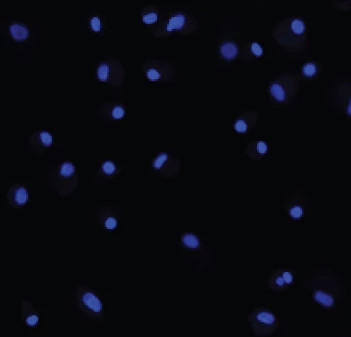 Blue fluorescent dots on a black background. This image is a high content image taken from the in vitro M1 Polarization Fibrosis assay at Charles River.