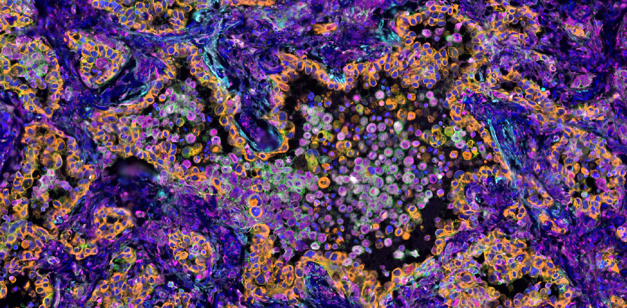 Color‑enhanced microscopic image showing clustered cells within complex tissue structures