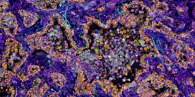Color‑enhanced microscopic image showing clustered cells within complex tissue structures