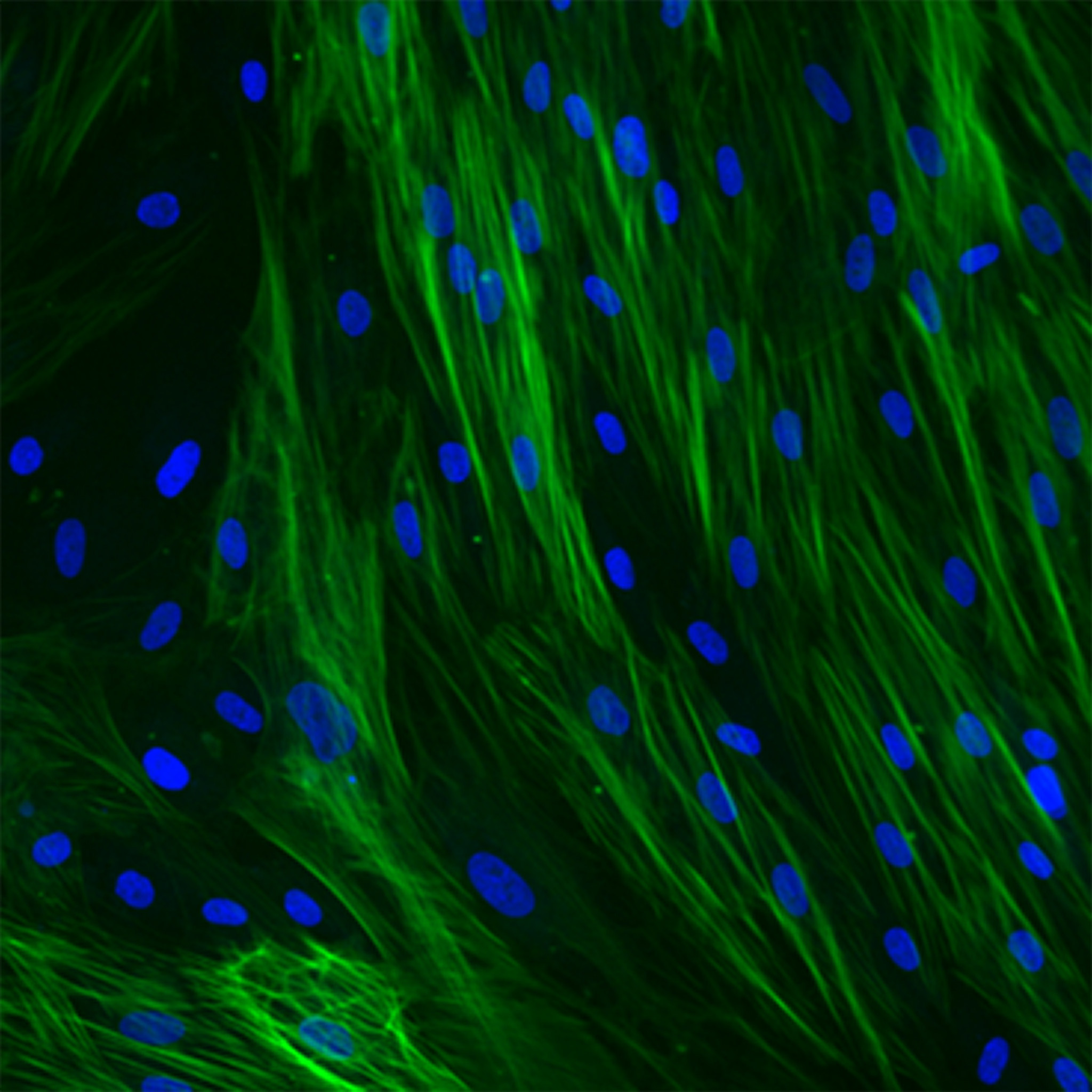 Green fluorescence with blue fluorescent dots. This image displays fibroblasts and was taken via high content imaging from the Fibroblast-to-Myofibroblast Transition (FMT) Fibrosis Assay at Charles River.