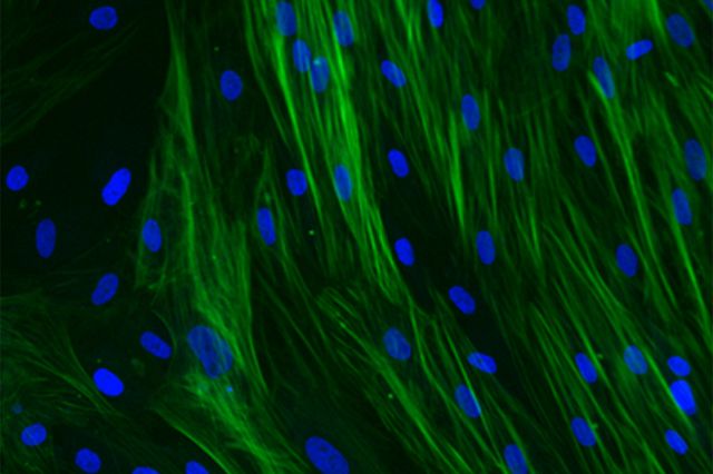 ipamorelin fibroblast Fibroblast-to-Myofibroblast Transition (FMT) Assay |