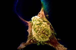 Metastasis of cancerous cell
