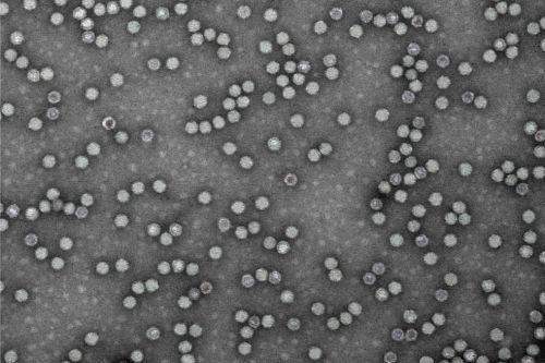 Learn more about our immuno-electron microscopy services to detect subcellular localization of test article and high-throughput quantification of full and empty AAV capsids for cell and gene therapy studies.