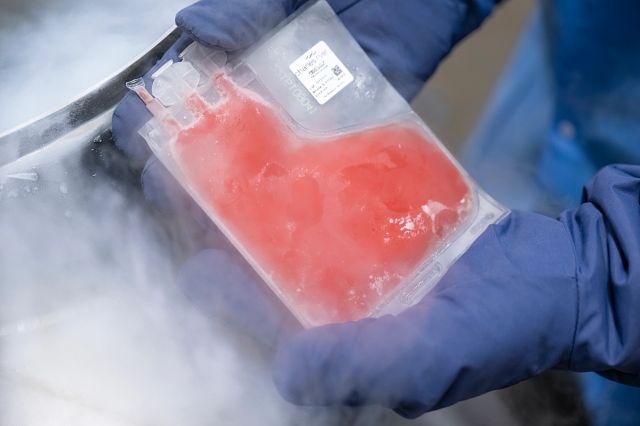 a cryopreserved leukopak