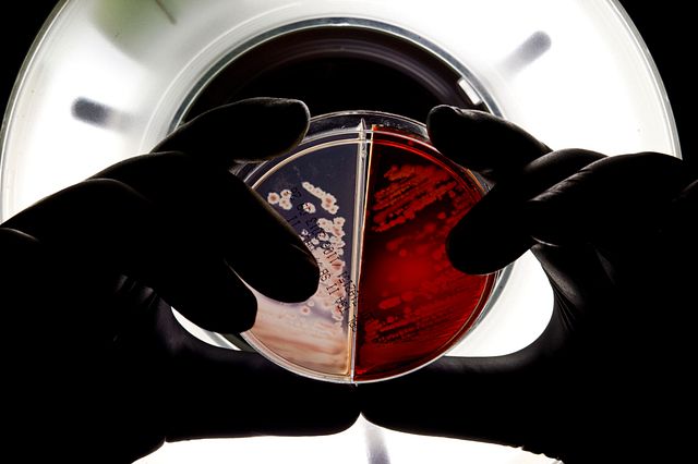 microbial sample plate for strain typing assay held by a QC microbiology laboratory technician