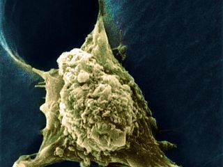 microscopic image of cancer cell