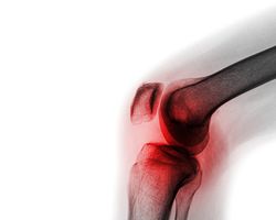 iStock-817480728.jpg