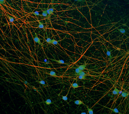 VGlut2 (green), b3Tubulin (red), and nuclei (blue) in bit.bio ioGlutamatergic Neurons
