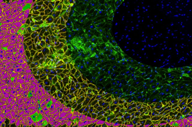 Stereology systems Stereology systems