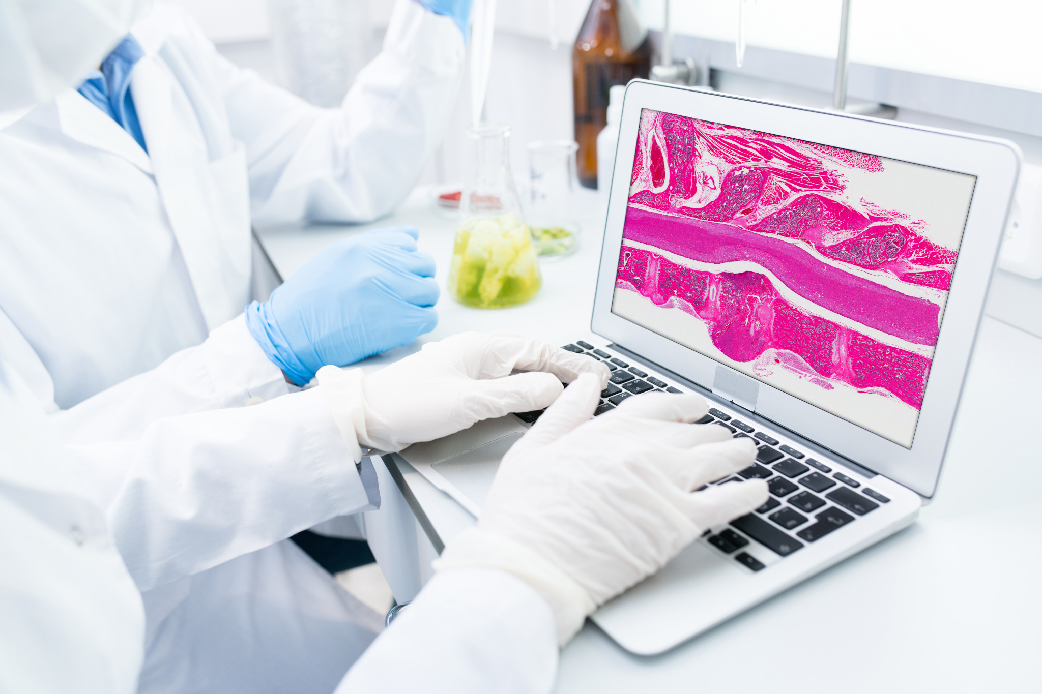 Digital Pathology