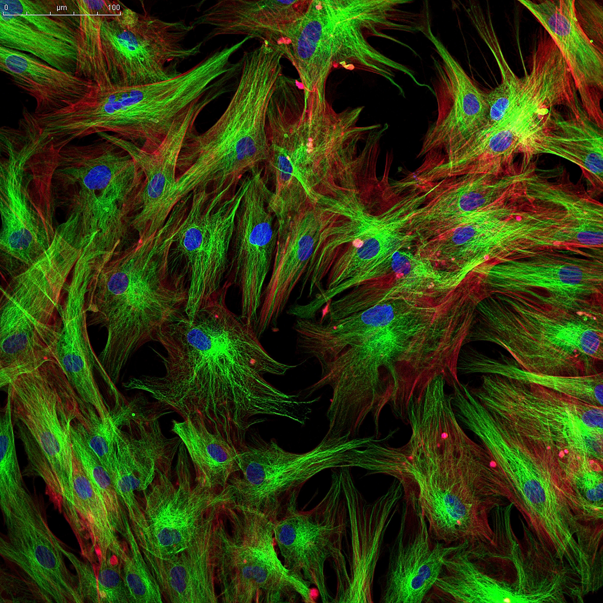 Fibroblast cell for in vitro immunology assay