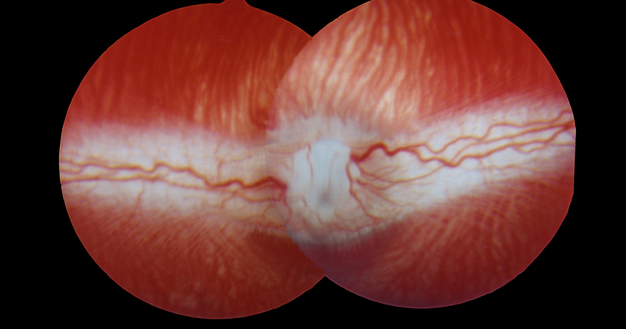 Photo showing the back of a large animal eyes, highlighting the dark reddish choroidal neovascularization.