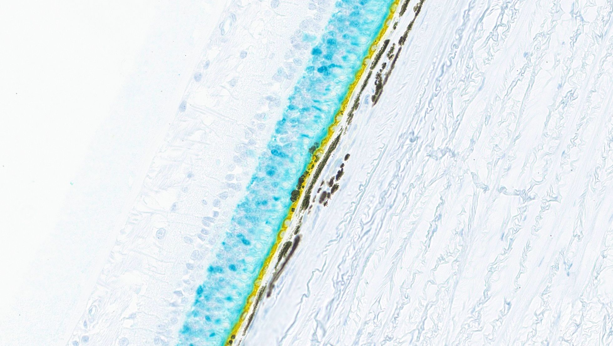 Large Animal Eye IHC Stain for RPE65+GFP
