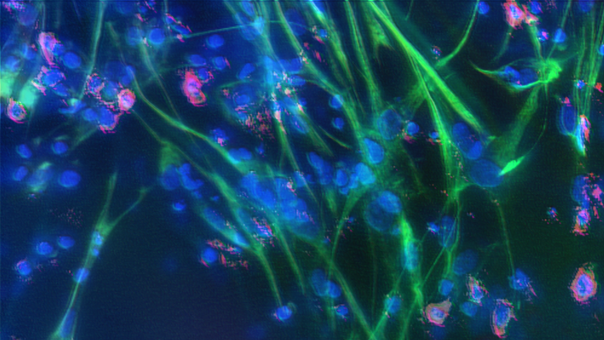 Oncology image