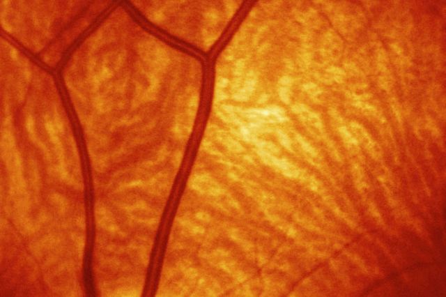 Picture of an eye to represent the ocular in vivo pharmacology studies offered at Charles River Labs to support your drug discovery.