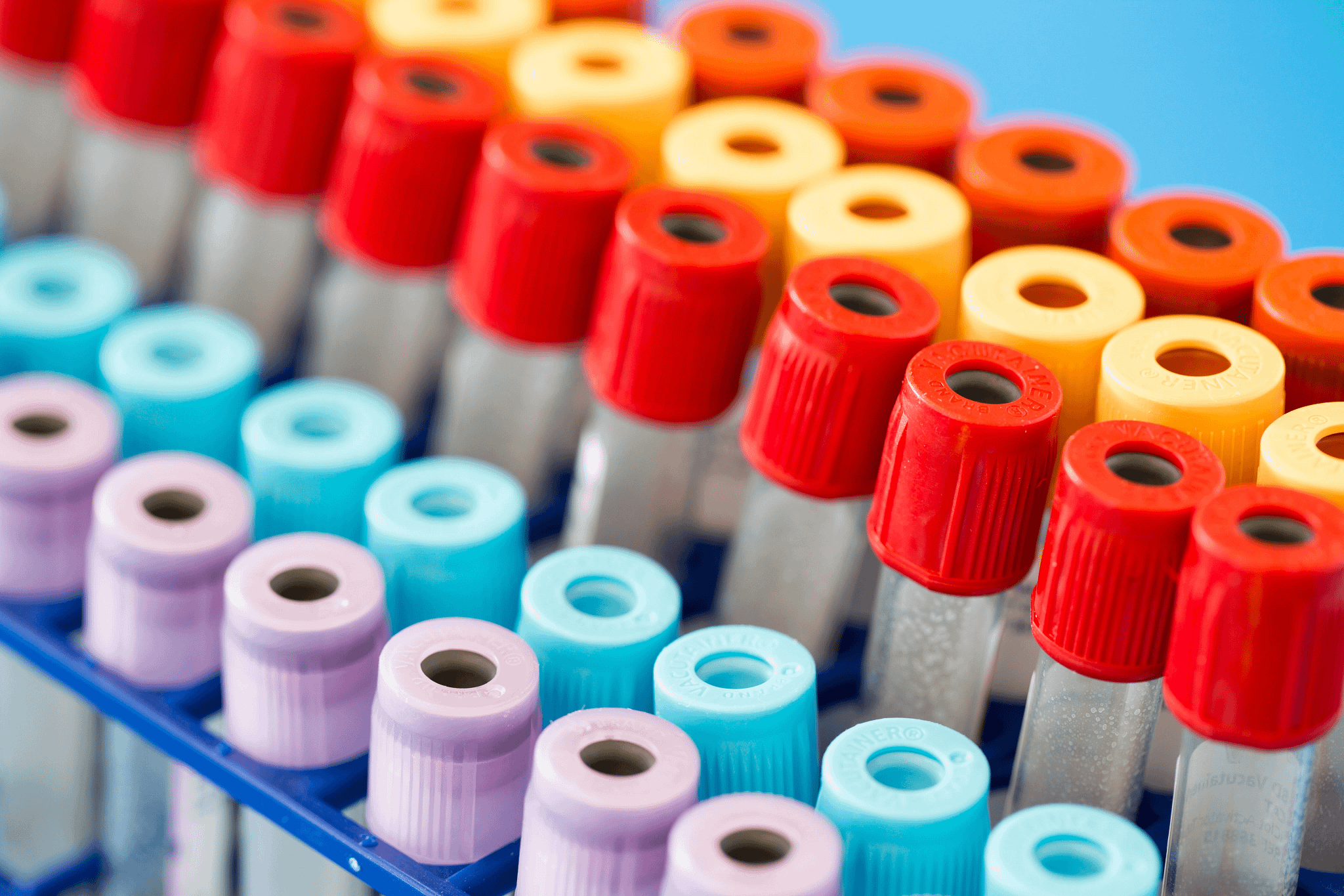 Vials of serum with colorful lids lined up in trays