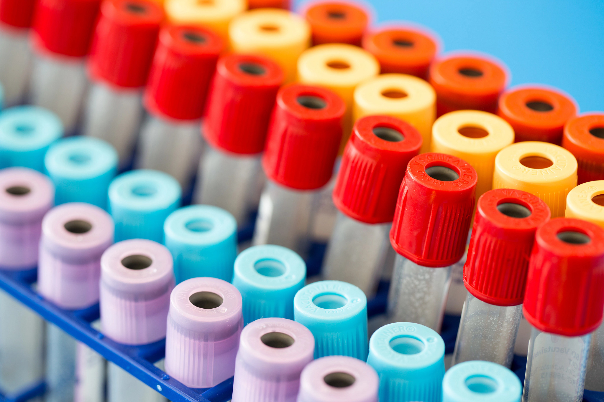 tube blood laboratory technology 