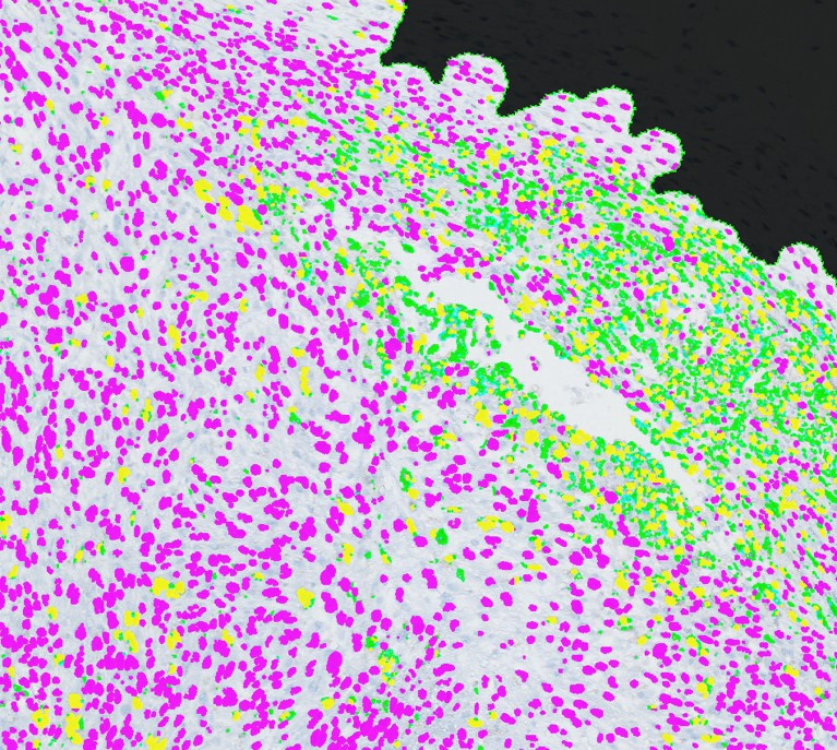 CD68 stain for macrophages within a mouse tumor.