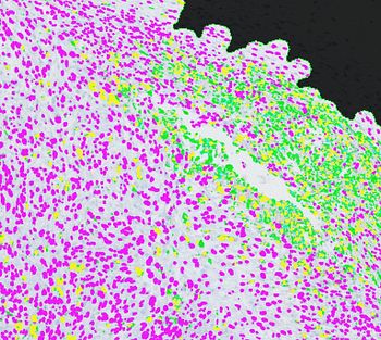 CD68 stain for macrophages within a mouse tumor.