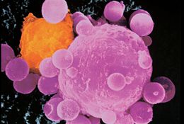 3D tumor models