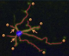 The image shows automated neurite outgrowth analysis using the CSIRO algorithm for quantification of maximum neurite length, number of extremities, number of roots, number of nodes, and total neurite length.