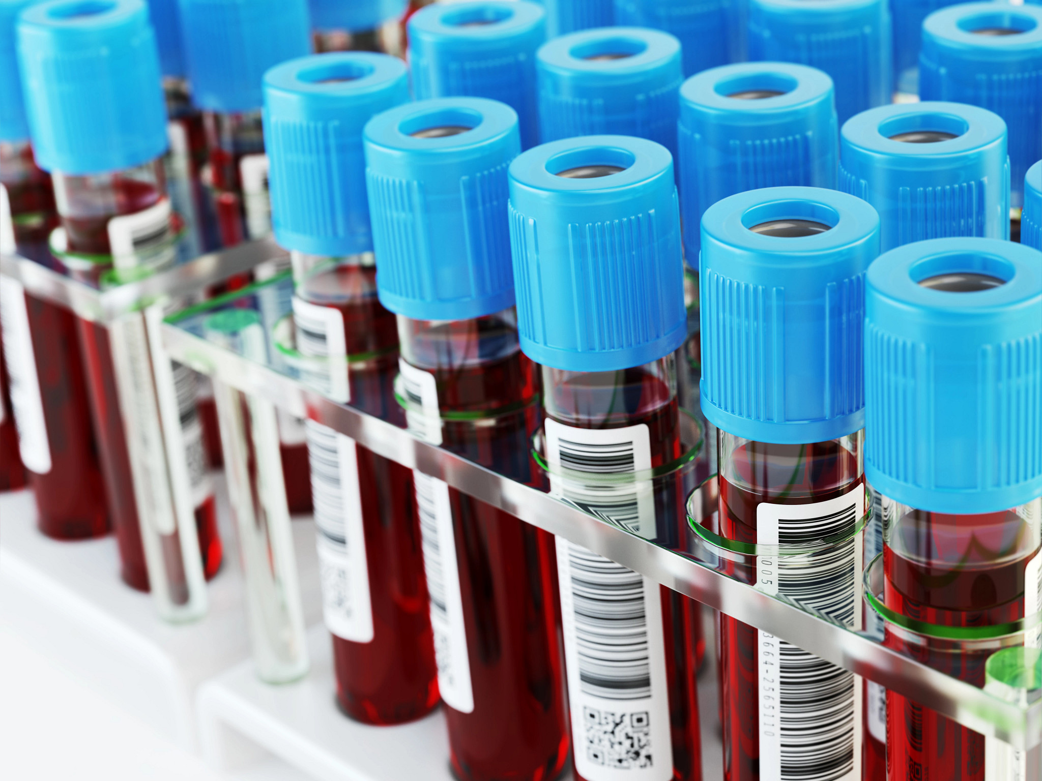 Vials with human blood samples for bile acid profiling arranged in a rack and marked with barcodes
